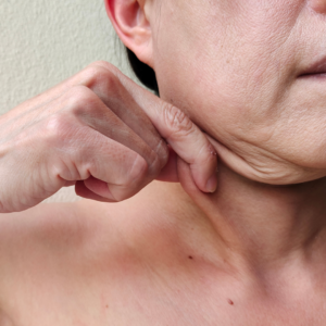 Tratamento da Flacidez